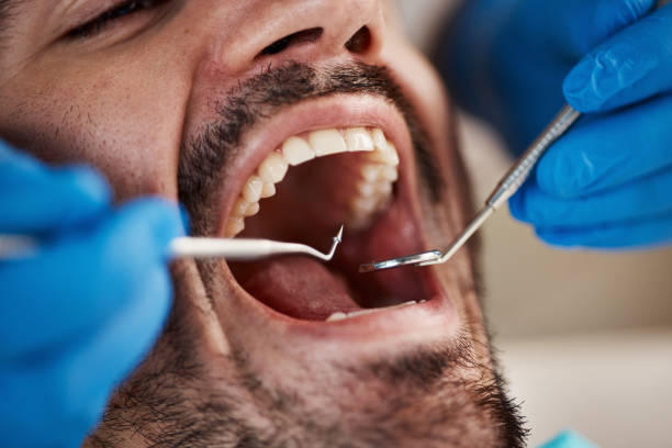 Best Cracked Tooth Emergency Dentist  in Golden Grove, SC